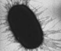 E. Coli bacterium with its Catch-Bonding filaments. [Gross L (2006), PLoS Biol 4(9): e314]